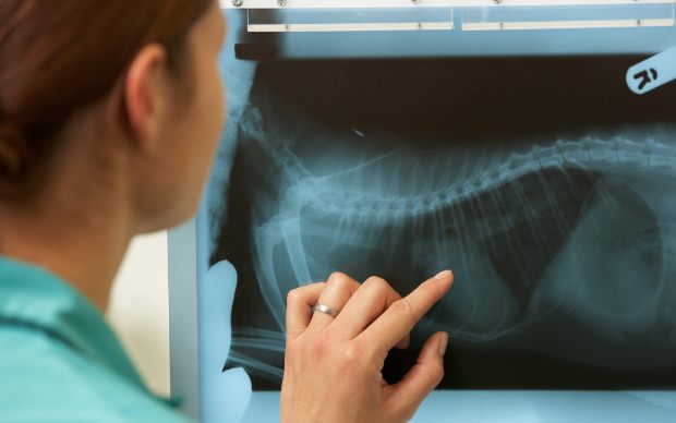 radiographie